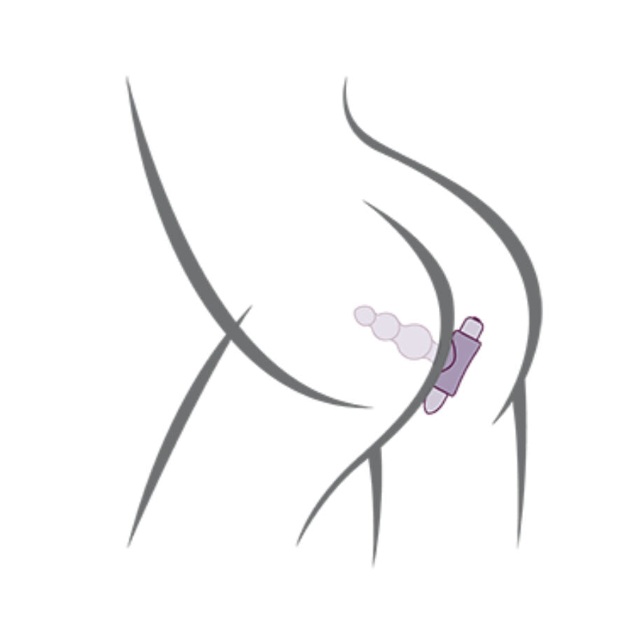 Petite Sensations Bubbles Anal Plug